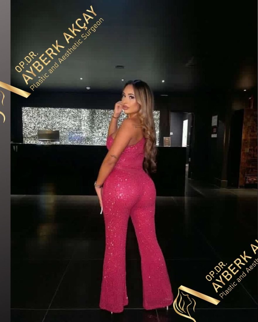 After photo only: a patient on a night out, her own lifestyle photo